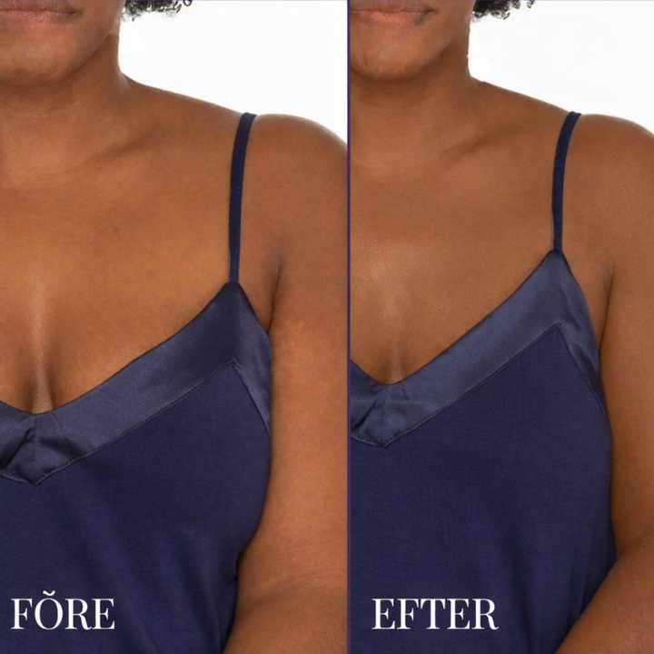 HudTäck™ - Kroppstäckande Concealer