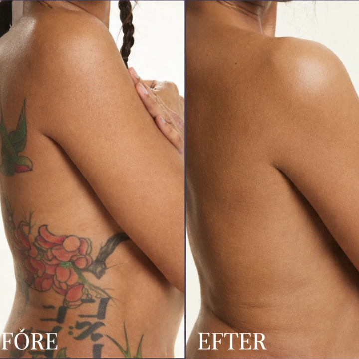 HudTäck™ - Kroppstäckande Concealer