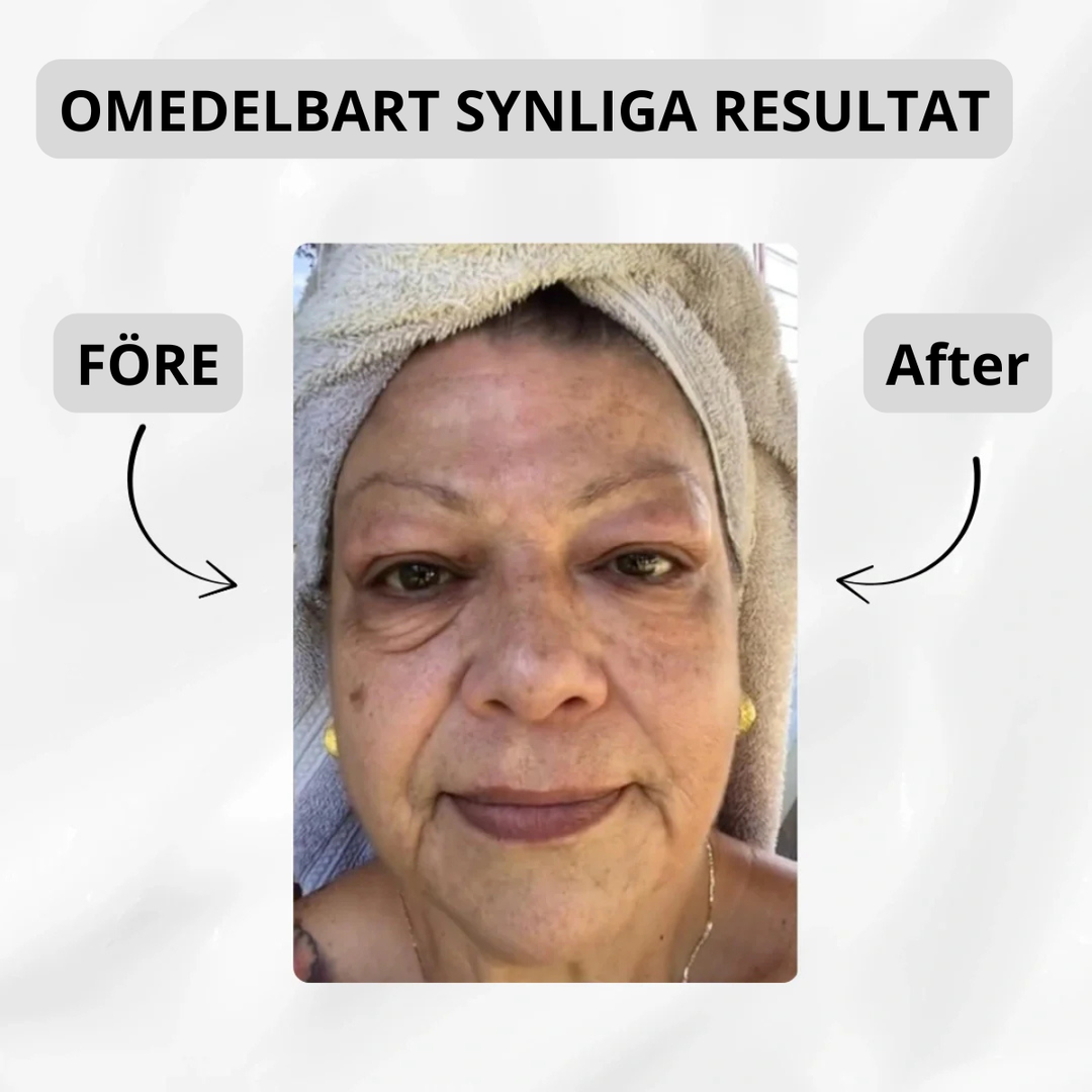 V-Lift Ögonkräm – Fastare ögonkontur