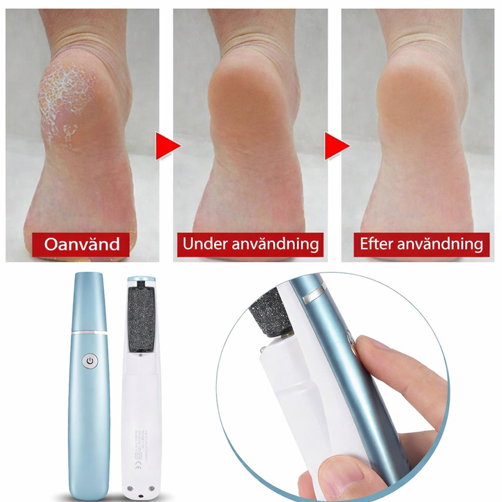 Elektrisk Fotfil mot Förhårdnader – Inkl. GRATIS Återfuktande Fotkräm